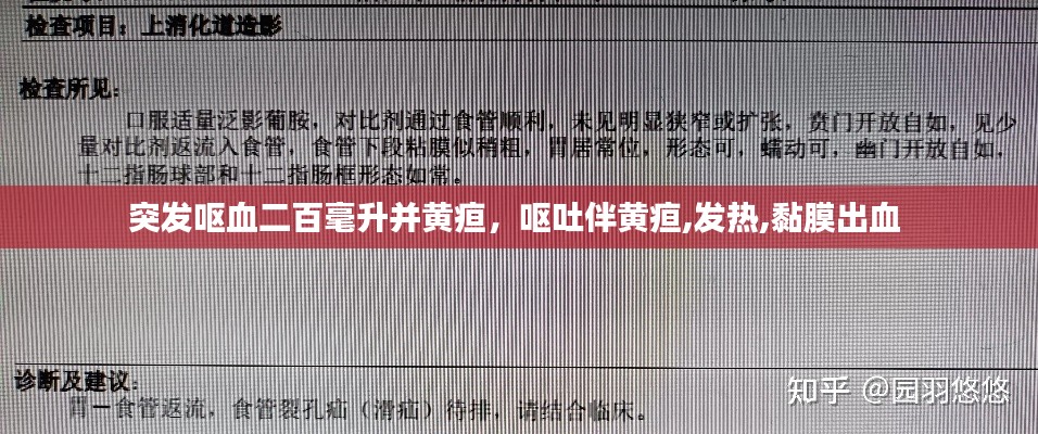 突发呕血二百毫升并黄疸,呕吐伴黄疸,发热,黏膜出血