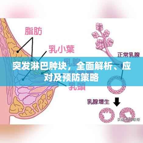 突发淋巴肿块，全面解析、应对及预防策略