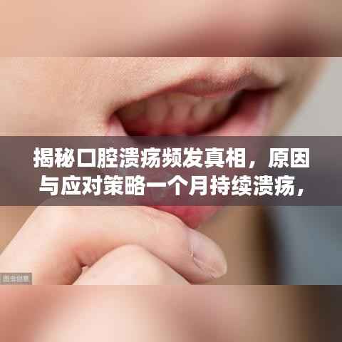 揭秘口腔溃疡频发真相，原因与应对策略一个月持续溃疡，如何应对？