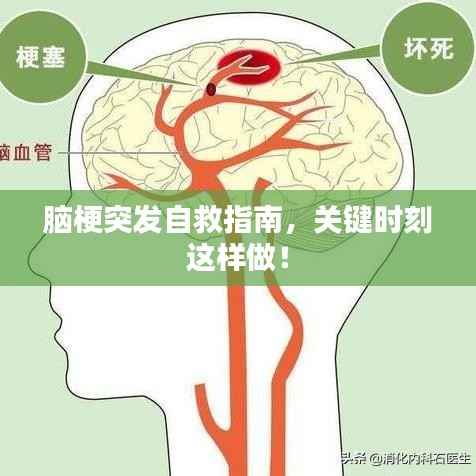 脑梗突发自救指南，关键时刻这样做！