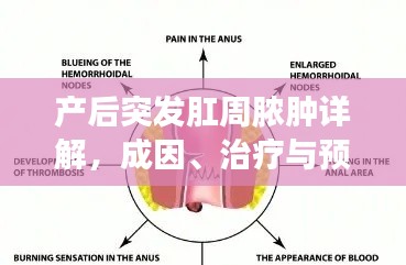 产后突发肛周脓肿详解,成因、治疗与预防攻略